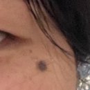 최용준성형외과의원 | [최용준 성형외과의원]