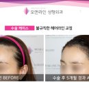 모앤라인성형외과의원 네이버블로그