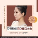 본디성형외과의원 | 광대뼈수술후기 넘치는 곳에서 만난 나