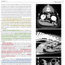 Retroperitoneal extra-adrenal paraganglioma가 있는 10마리의 개에서 영상 features 이미지