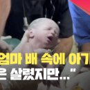 엠와이프로헤어