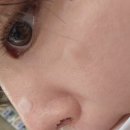 뮤즈의원 | 수원 인계동 뮤즈의원 피부관리 후기 | 레이저토닝 아쿠아필 관리 솔직후기