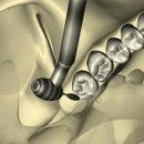 세라믹치과의원 이미지