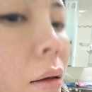 대구입술문신, 말이 많은 직업이라 더 오래 고민했어요 | 세이지뷰티입술 후기
