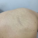 스킨52부천지부 이미지