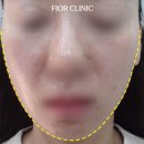 피오르의원 이미지