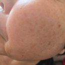 디엠디(DMD)