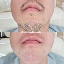 도계주유소(도계동.의창스포츠센터방면) | 헤어라인(여)