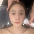 창원피부관리 잘하는 라우라에스테틱에서 윤곽축소 만족 후기