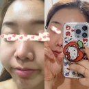 동안비결Beauty | 속 건조 잡는 물광 피부 비결! 슈퍼젝션 홈 키트로 끝내는 3단계 탄력 케어