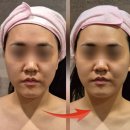 김포 피부관리 구래동 김포피부예술 손기술 윤곽라인정리 후기