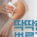 삼성서울오외과의원 네이버블로그