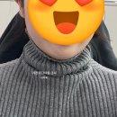여신티켓 추천인코드 및 여신티켓에서 유명한 강남 인모드fx 얼굴전체 솔직후기
