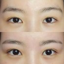 용산-356 | 이태원왁싱샵 [코멜리슈가링왁싱] 페이스왁싱 솔직후기 :: 용산슈가링왁싱 | 용산브라질리언왁싱
