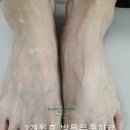 행신준재활의학과의원 네이버블로그
