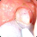 조은오산병원 이미지