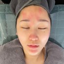 부산 동래 우아에스테틱에서 물방울 초음파 수분관리 받은 내돈내산 후기
