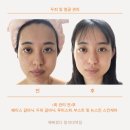 김윤정 스킨&바디 | 왜 뷰티샵에서 뉴스킨 제품을 쓸까? 나의 뉴스킨 비포&amp;에프터의 모든 것 (찐 후기)