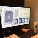 엑셀고급 | 선릉역피부과 엑셀웨이브 이중턱리프팅 효과 팔자주름 심부볼 후기