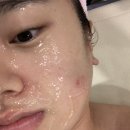 뷰티호텔 이매점 | 분당 피부관리 뷰티호텔 가서 마스크 트러블 피부해독 하고 왔어요