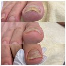 닥터아이티엔아나스네일 | 고양내성발톱 오랜 경력의 원장님 직접 관리하는 곳 도도스네일