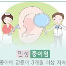 만성 중이염 삼출성중이염 방법 이미지