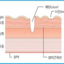 빈속에 진통제 위장 장애를 일으키는 요소는? 이미지