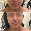 미당 에스테틱 | 창원 마산 피부관리 윤곽 리프팅 “드웰에스테틱” 신부관리 추천 솔직후기