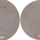 아이비에스테틱 이미지