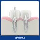 맥치과기공소 이미지