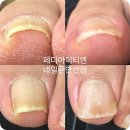 네일죤 - 남구 삼산동 | 네일죤