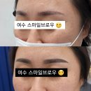 스마일브로우