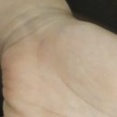 호랑약국 | 유아 수족구 구내염 엘레멘 에프시럽 먹고 밥 넘긴 후기 비타민B