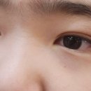 구로밝은빛안과의원 이미지