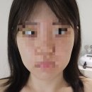 디테일라운지 | 이천 윤곽관리 디테일한 후기 <헤르츠 뷰티라운지> 뉴소닉 초음파 피부관리와 수기 물방울 리프팅까지