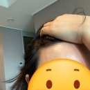 수북좋은약국 | 갱년기 탈모, 노화 탓만 할까요? 제가 만족한 관리법은요