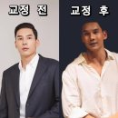 클리어치과의원 | 잠실새내 치과 교정 추천 이유 성인 인비절라인으로 건강까지 잡은 후기