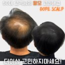 돕스칼프 이미지