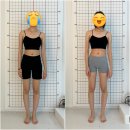 내몸에깃든바른자세운동 | “18세 여학생 척추측만 교정 중간점검 | 내몸에깃든 바른자세운동 아산탕정 본점”