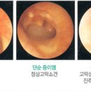 소리코이비인후과 이미지