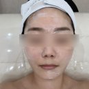 [천안 잡티제거] 더레이디뷰티 샤넬관리 후기