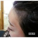 수앤미헤어라인 - 수원시 장안구 덕영대로425번길 14-1 | 수앤미헤어라인