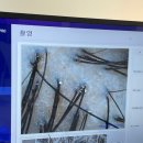 강화에너지 주유소 | 서초두피케어 신사역두피관리 추천｜탑스칼프 서초점 복합성두피관리 후기