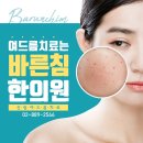 바른침한의원 네이버블로그