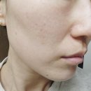 메디율 | 환절기 영양크림 추천 메디율 율무크림 솔직후기