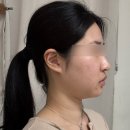 400 | [도곡] 얼굴선 착붙 팔자 다림질 감동해버린 도곡 올타이트 400샷 찐찐후기