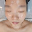 부천피부관리 닥터수 중동점에서 꼼꼼한 수기관리 받고 온 후기