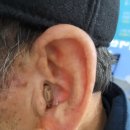 부안보청기 이미지