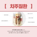 감일나무치과의원 네이버블로그