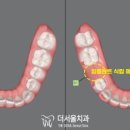 팜치과의원 네이버블로그